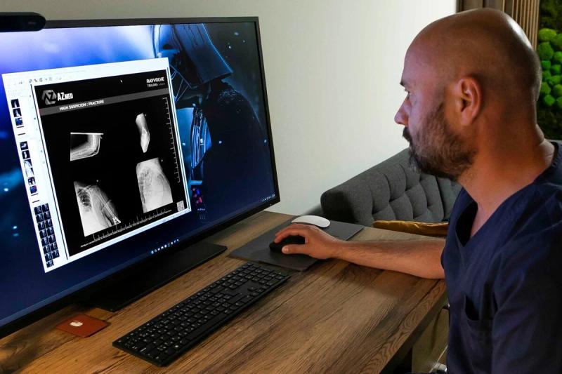 Röntgeny vyhodnocuje v košickej univerzitnej nemocnici aj umelá inteligencia