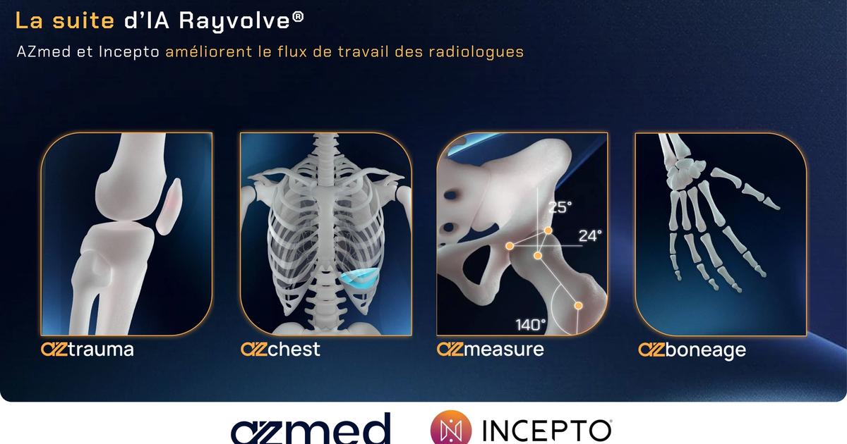 AZmed et Incepto améliorent le flux de travail des radiologues