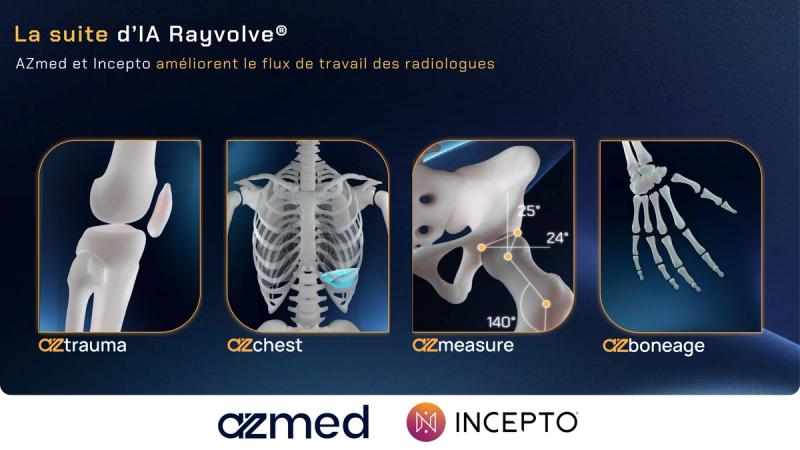 AZmed and Incepto improve radiologists’ workflow