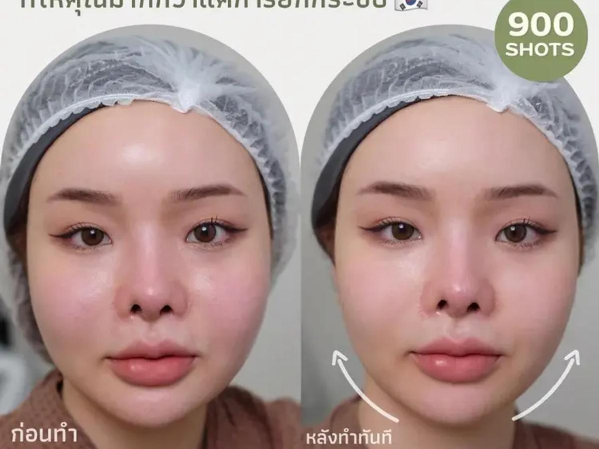 รีวิว LIFU