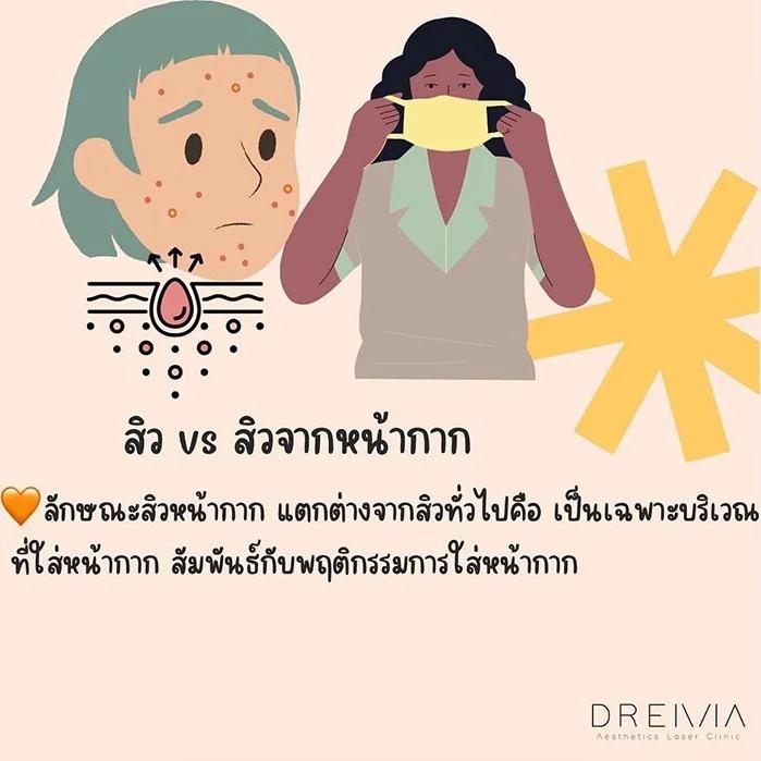 Maskne ( สิวจากหน้ากาก)