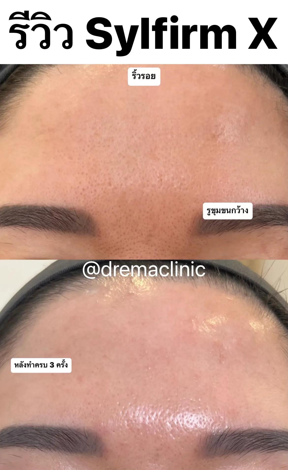 รีวิว SYLFIRM X 24