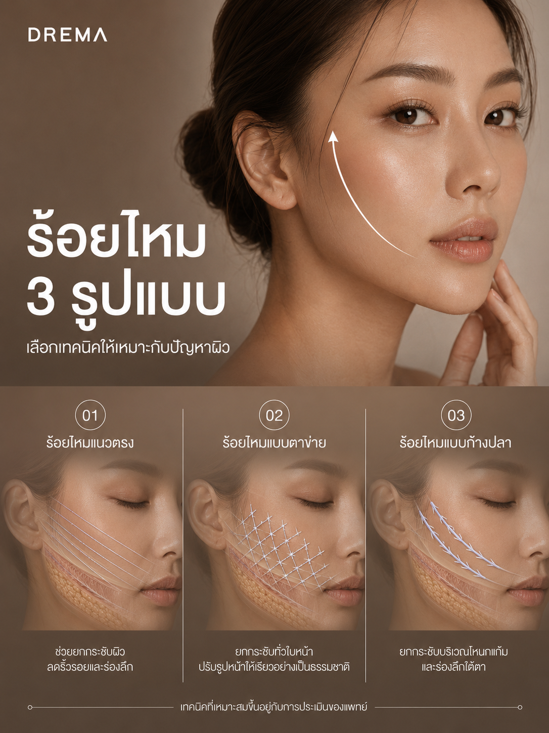 ร้อยไหม 3 รูปแบบ