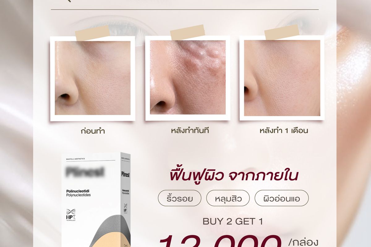 ภาพหลังทำ