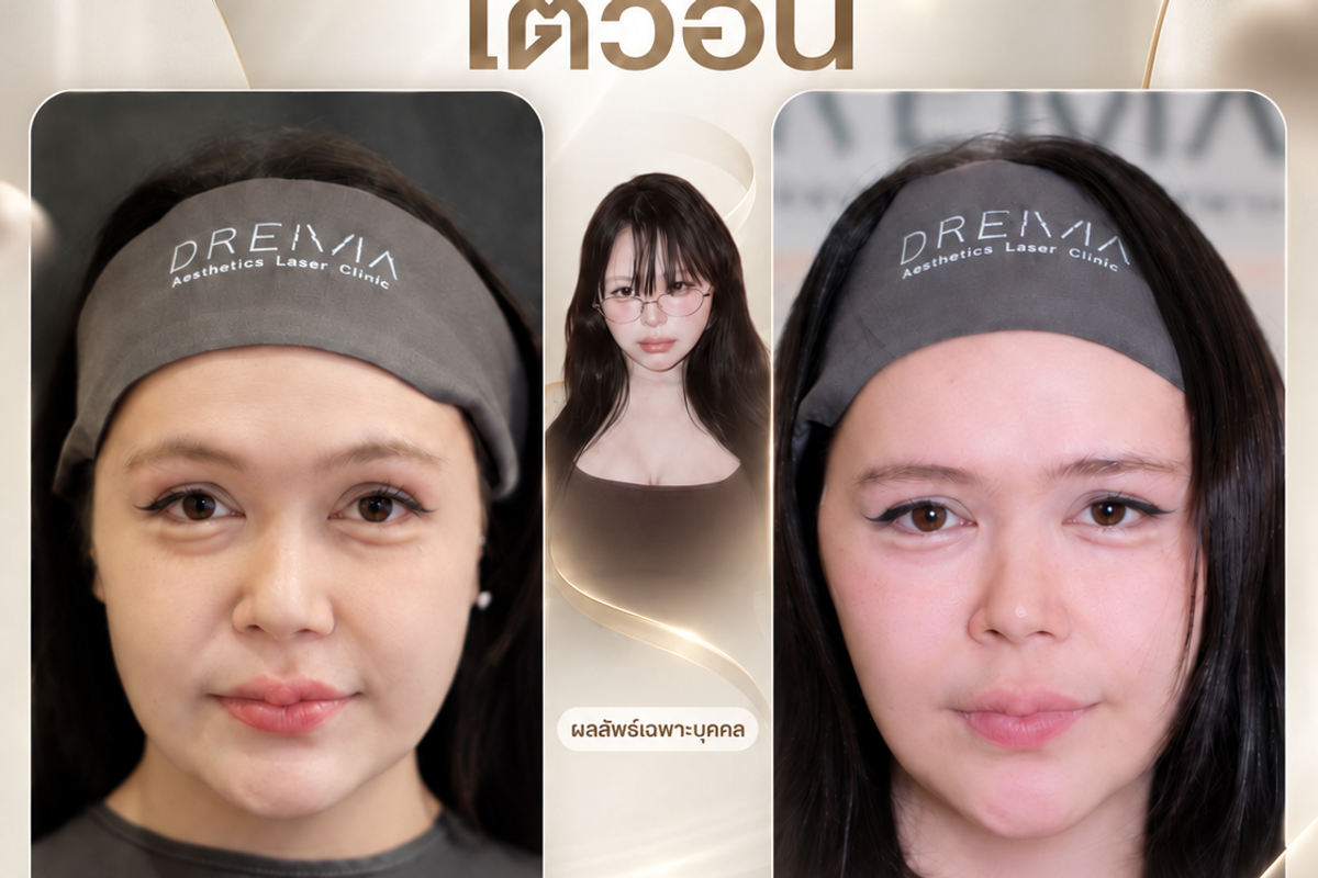 ก่อนและหลัวร้อยไหม