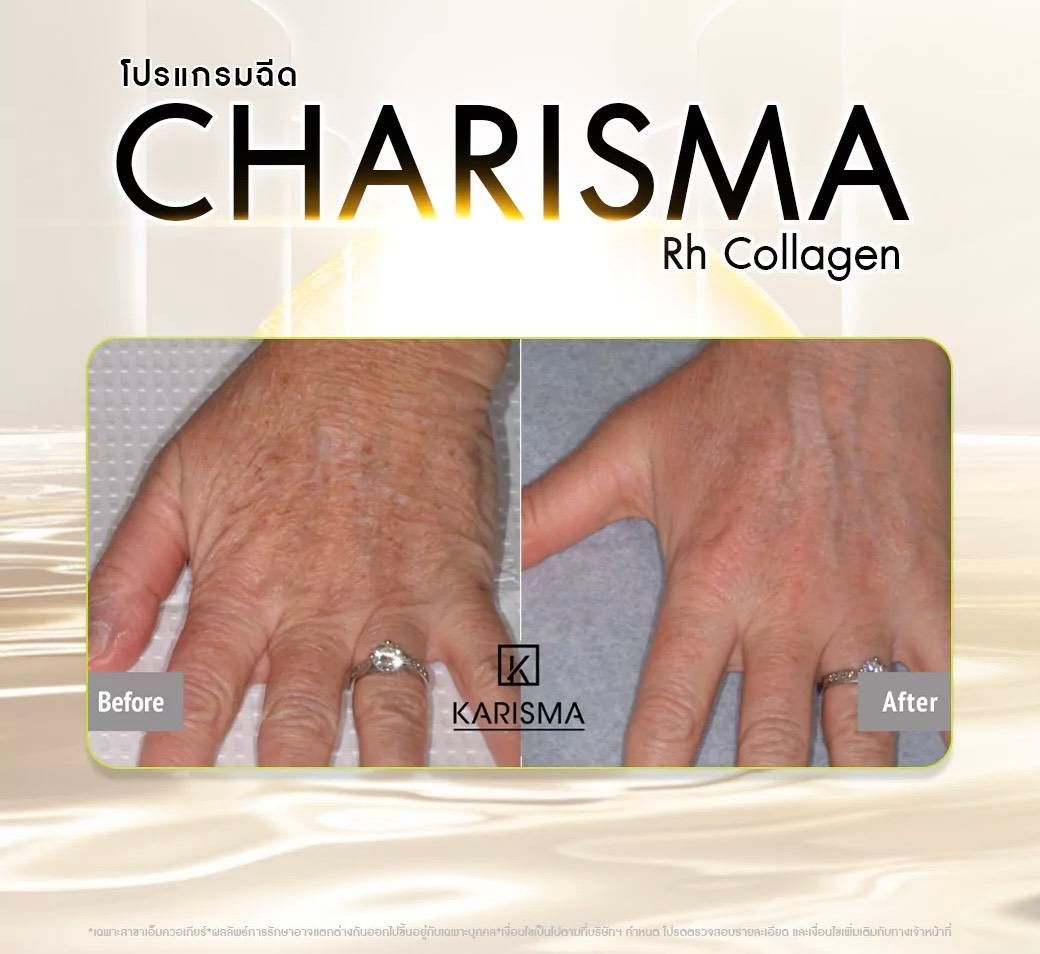 รูปรีวิว Skin Booster Drema Clinic เคสที่ 12