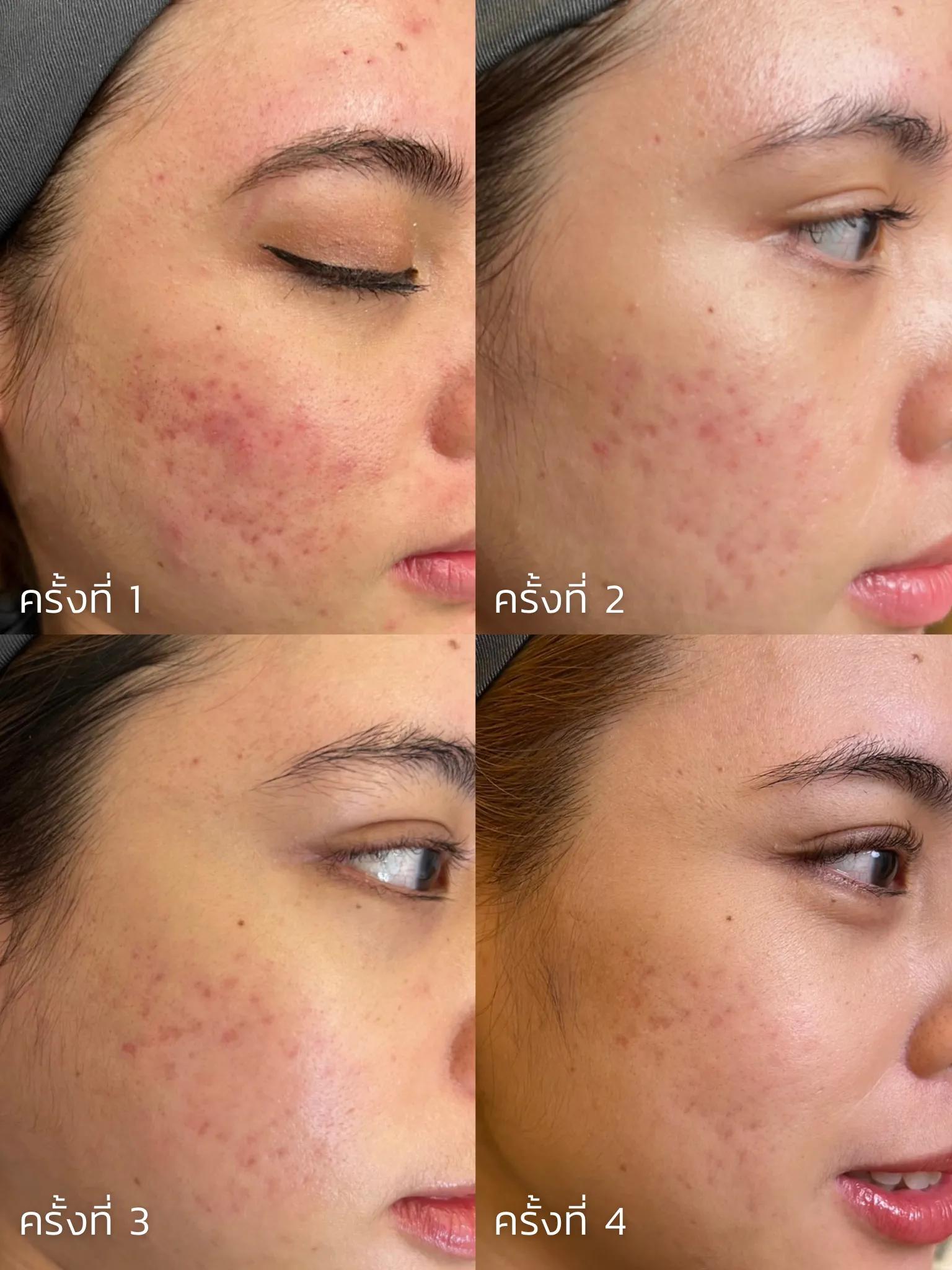 รีวิว SYLFIRM X 28