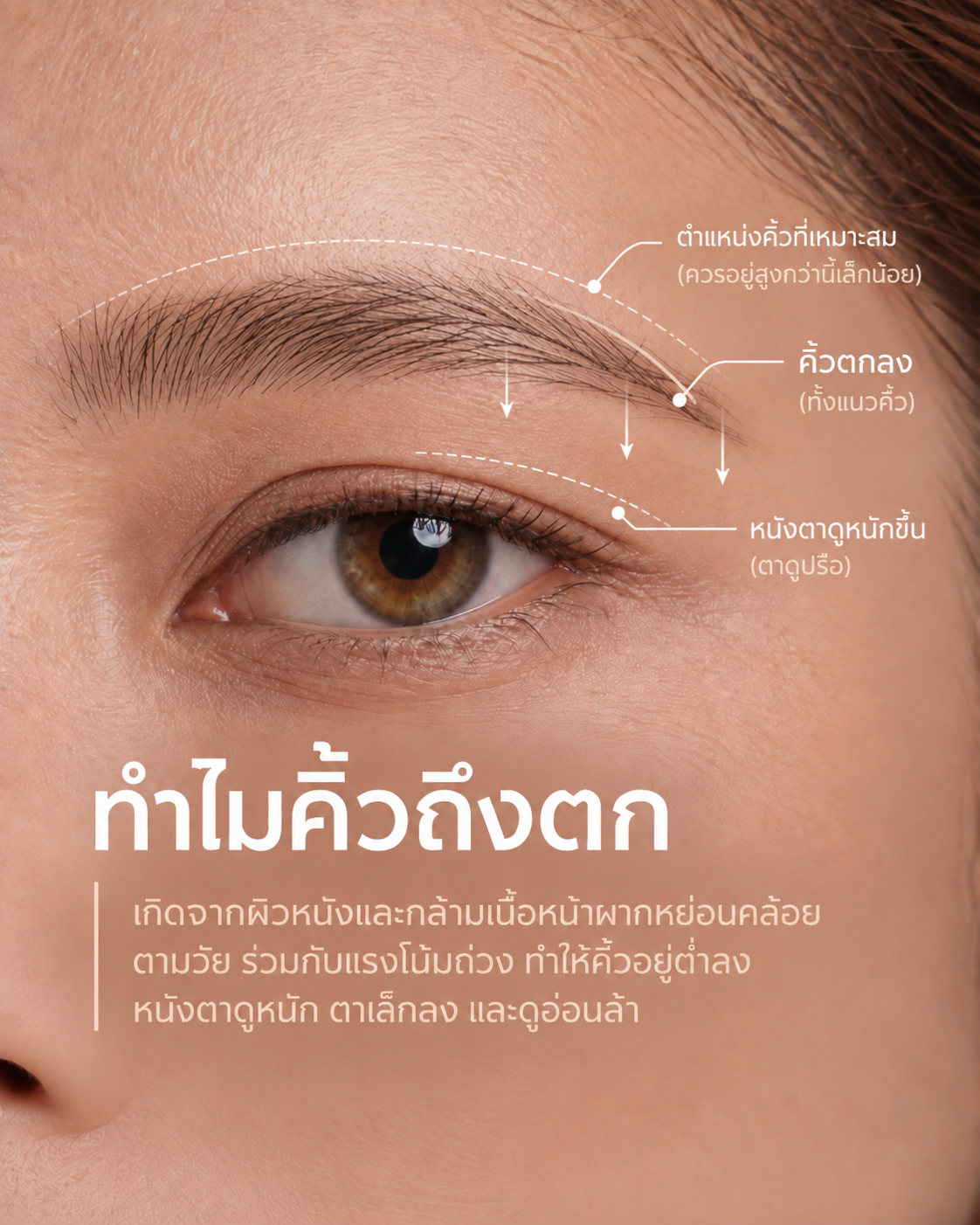ทำไมคิ้วถึงตก