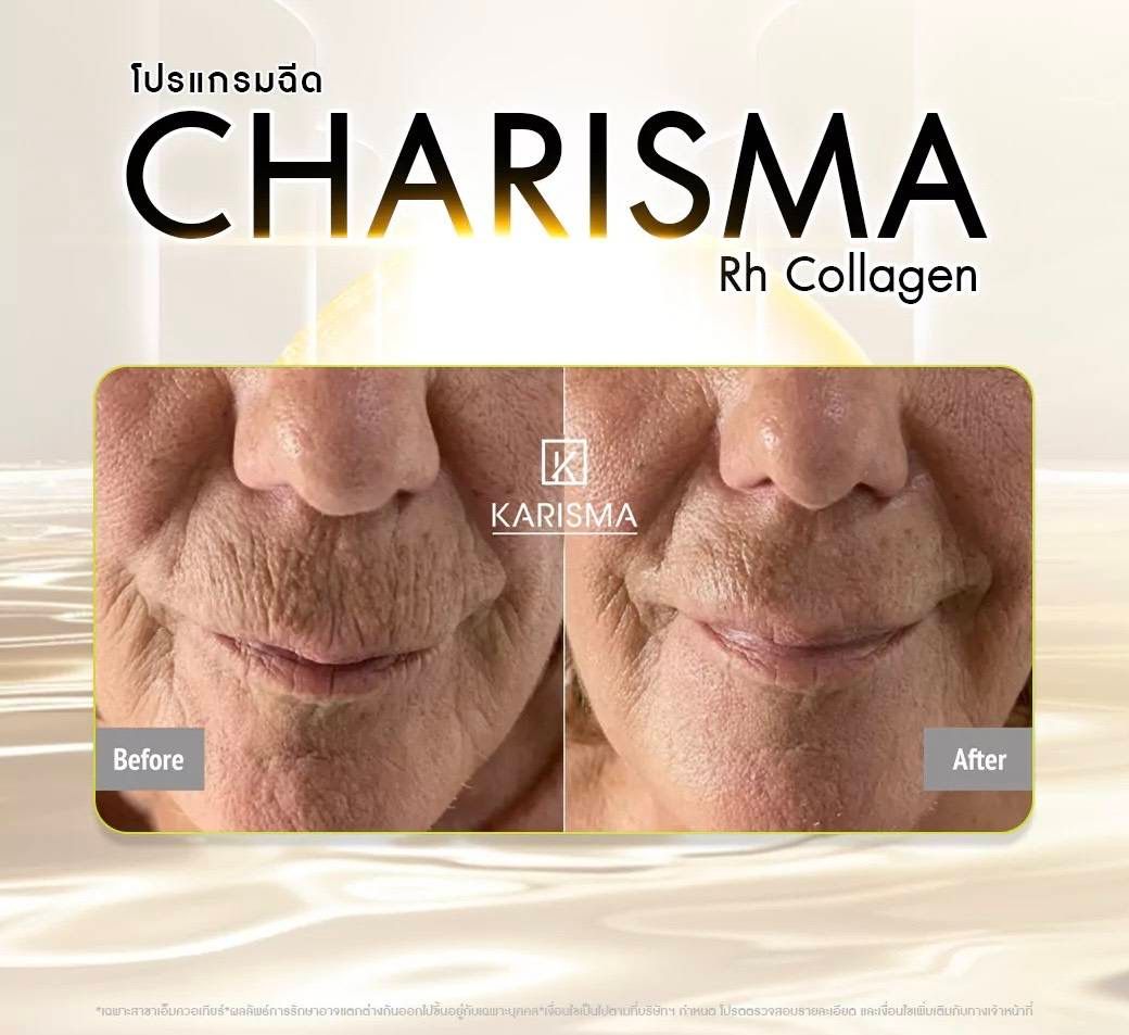 รูปรีวิว Skin Booster Drema Clinic เคสที่ 10