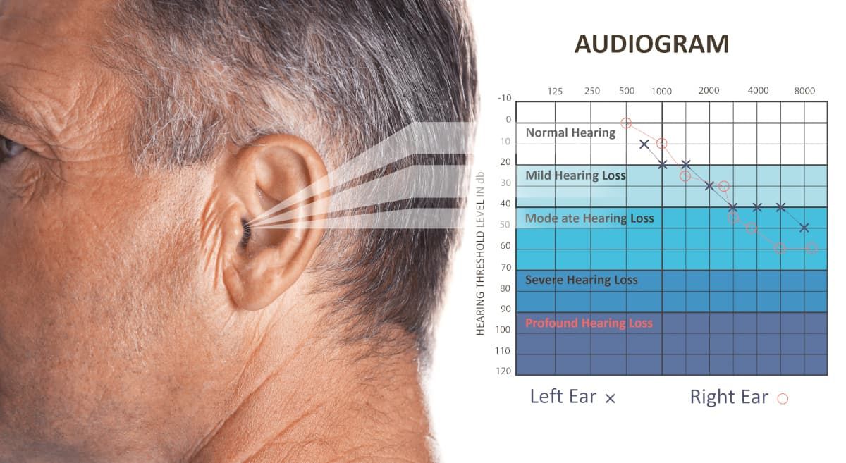 What Are The Different Types And Degrees Of Hearing Loss?