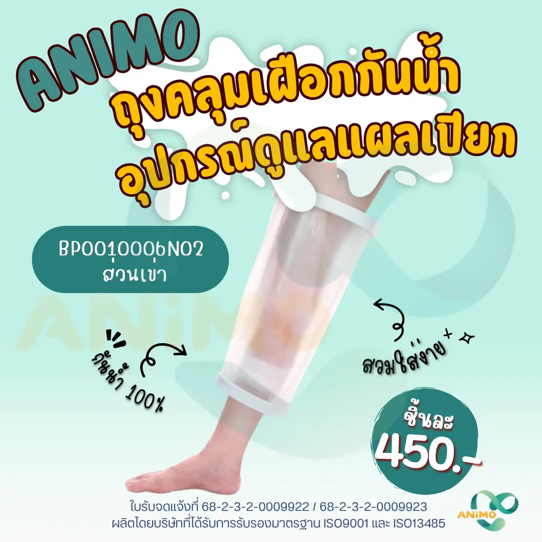 Waterproof Cast Protector for Shower – ปลอกกันน้ำสำหรับเฝือก ขณะอาบน้ำ