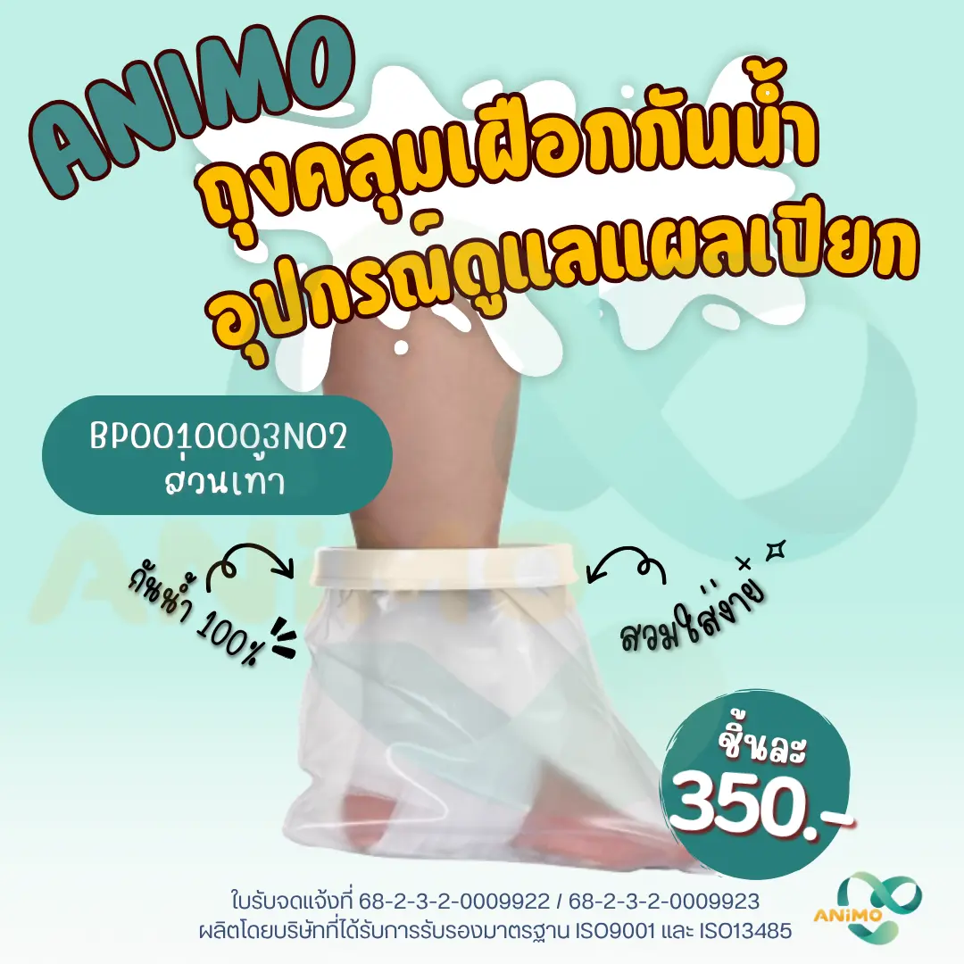 Waterproof Cast Protector for Shower – ปลอกกันน้ำสำหรับเฝือก ขณะอาบน้ำ