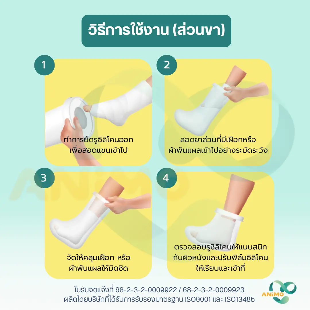 Waterproof Cast Protector for Shower – ปลอกกันน้ำสำหรับเฝือก ขณะอาบน้ำ