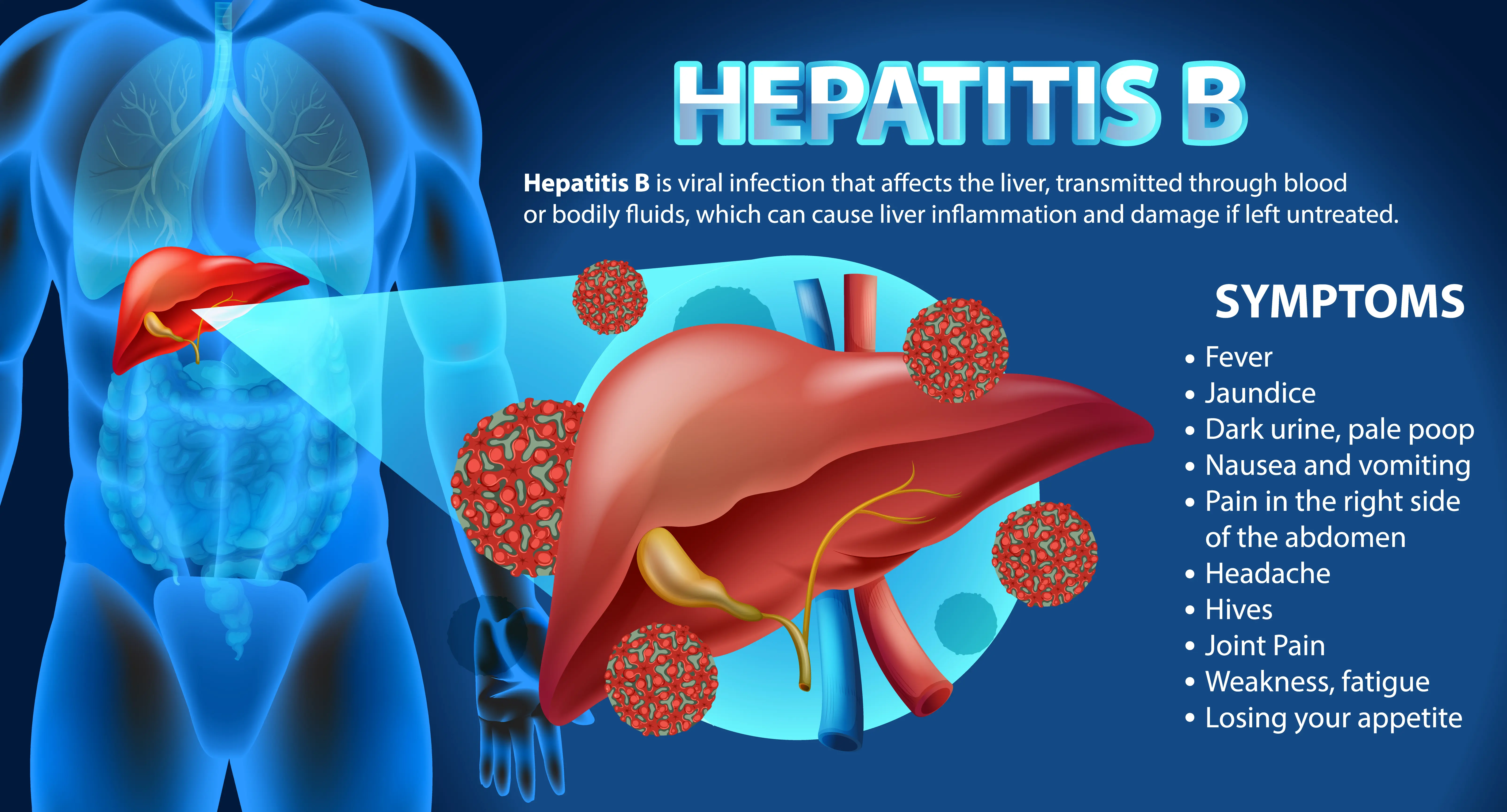 Illustration of Hepatitis B infection showing a human torso with the liver highlighted. The image depicts red viral particles attacking the liver. Text explains Hepatitis B as a viral infection transmitted through blood or bodily fluids that can cause liver inflammation and damage. Listed symptoms include fever, jaundice, dark urine, pale stool, nausea, vomiting, right-sided abdominal pain, headache, hives, joint pain, weakness, fatigue, and loss of appetite.