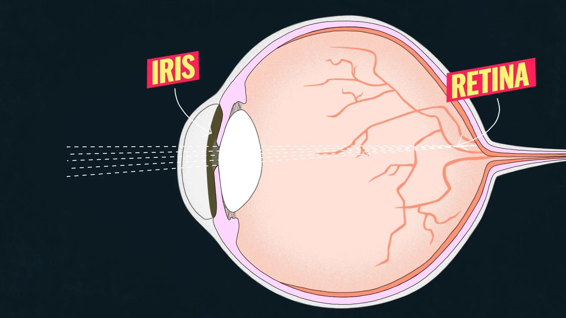 This is why you need special sunglasses to view the total eclipse
