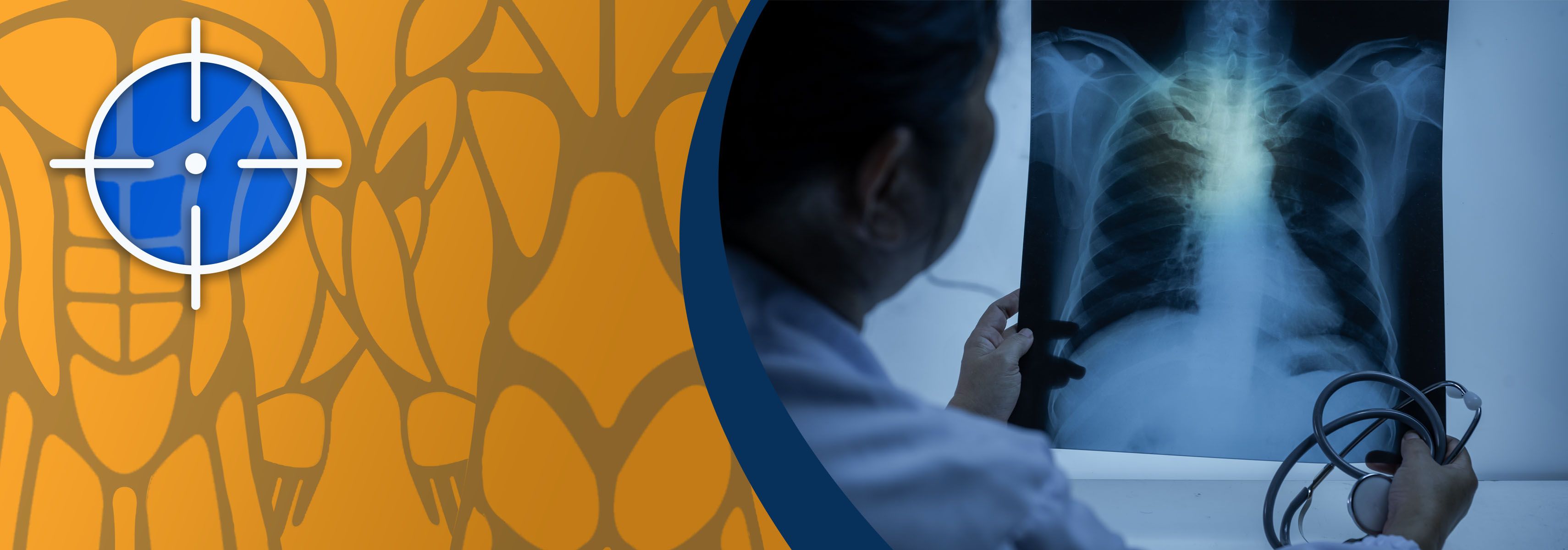 Rippe gebrochen oder geprellt