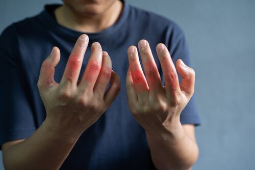 unterschied zwischen rheuma und arthrose