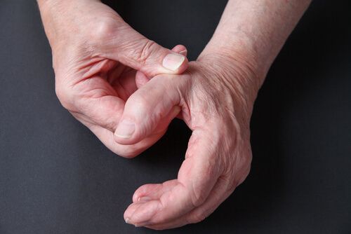 Thumb capsule joint problems