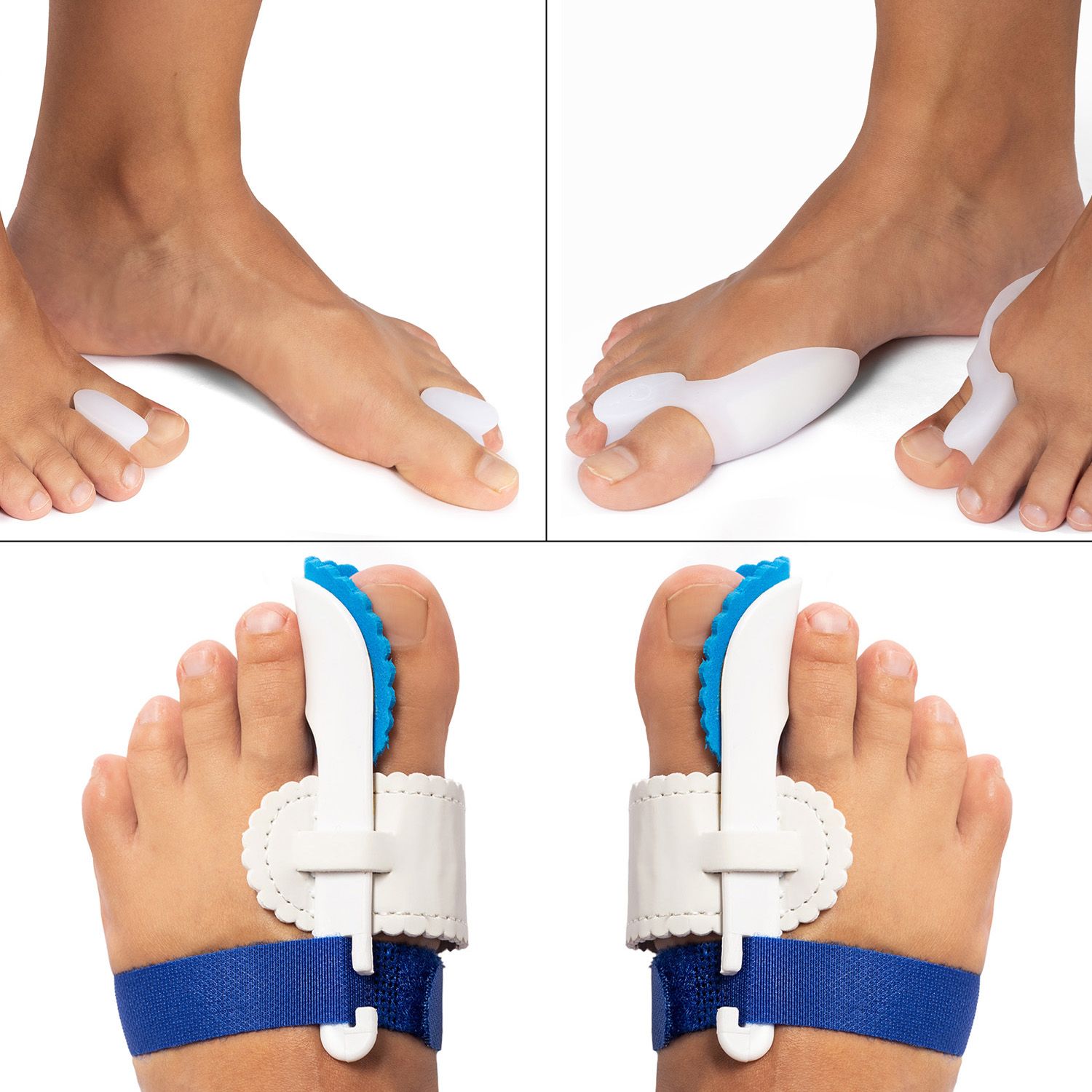 hallux valgus advantage package all products pictured