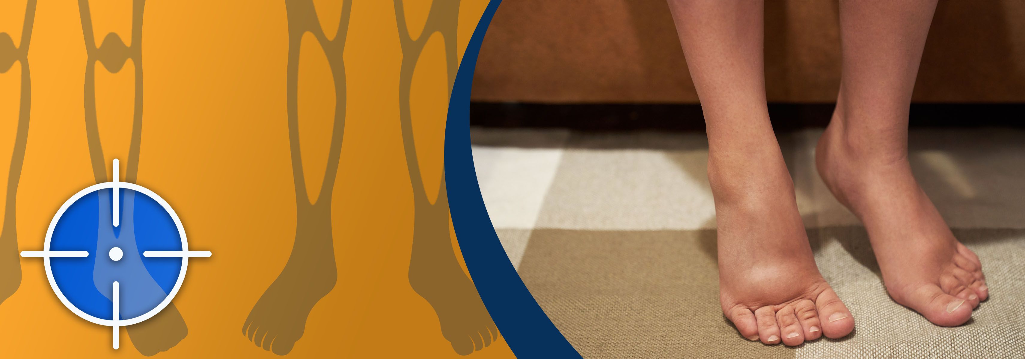 Flüssigkeit in den Beinen nach dem Fliegen