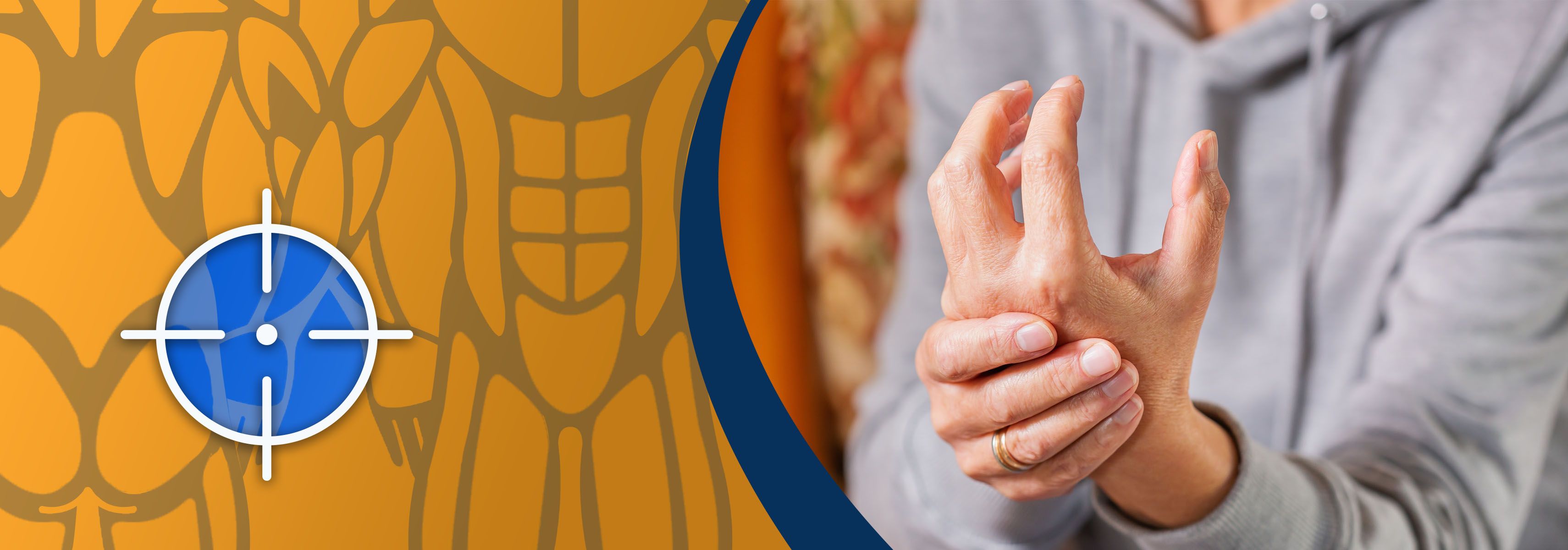 what is rheumatoid arthritis