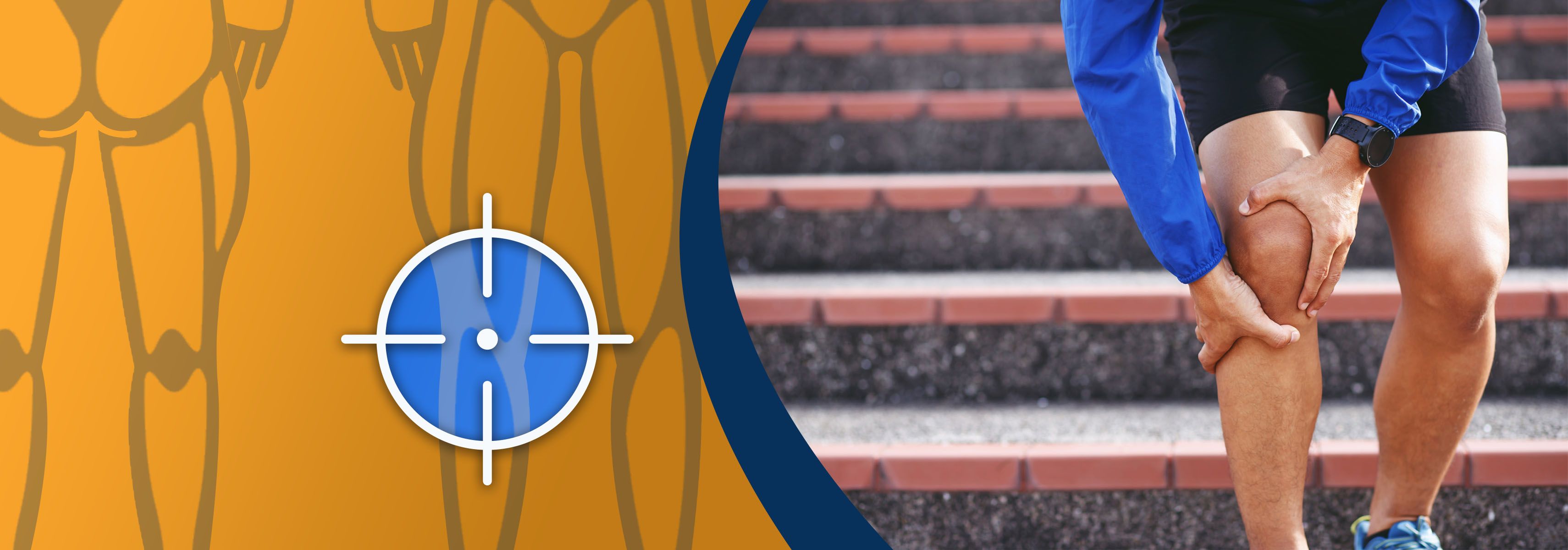 Knieschmerzen beim Treppensteigen