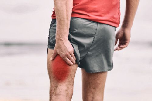 acute hamstring injury