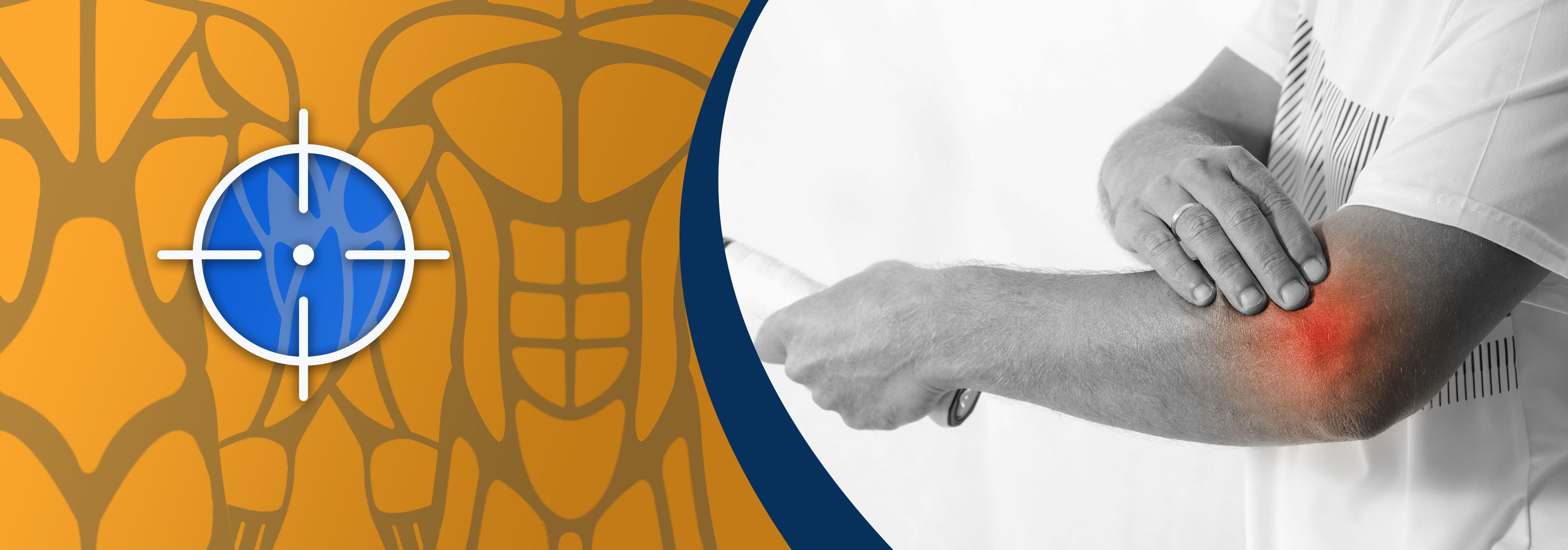 The best ways to treat a tennis elbow