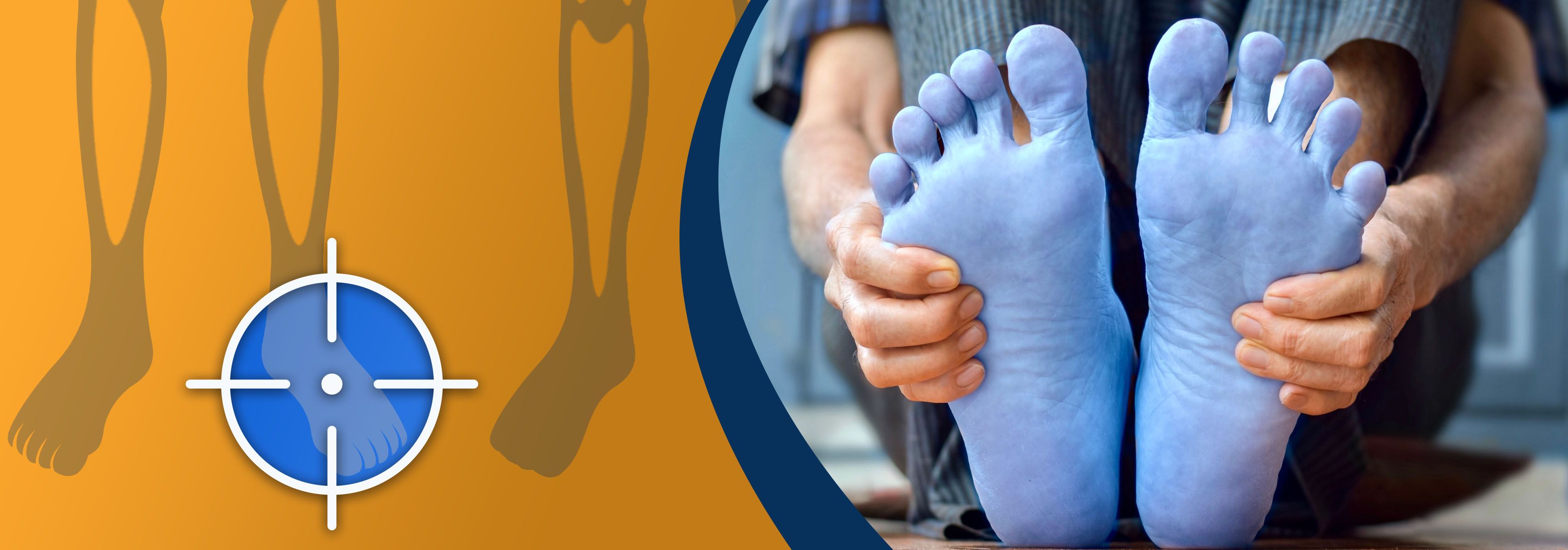 what can you do against chilblains