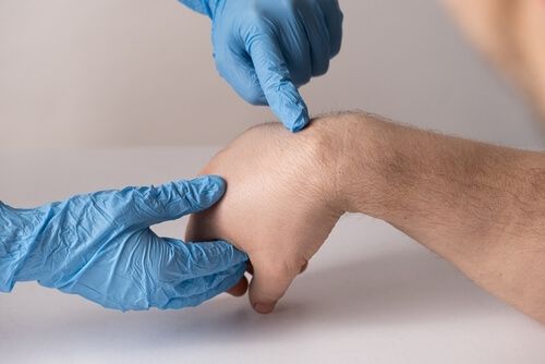 ganglion handgelenk