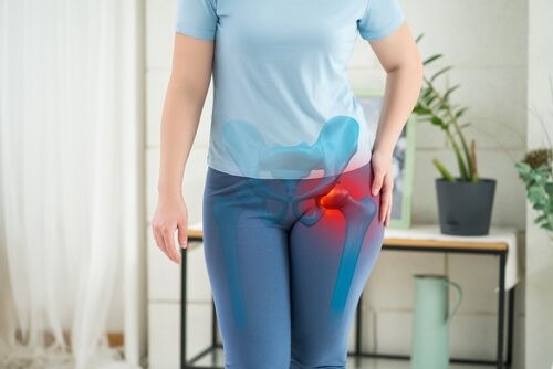 arthrose hufte