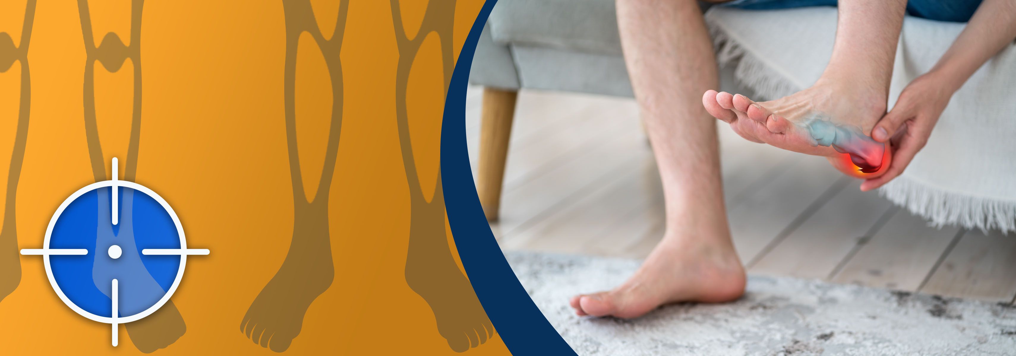 should you rest with heel spur