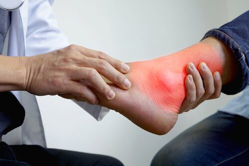 ankle rheumatoid arthritis