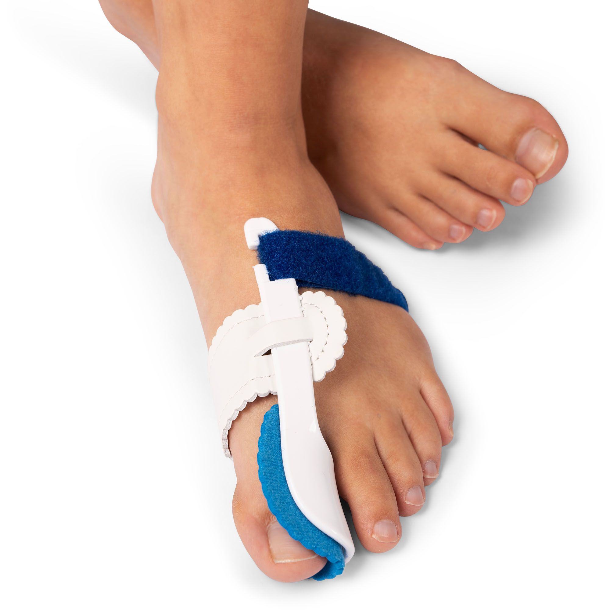 Hallux Valgus Schienen Duo-Pack – Nachtschienen (Paar) um linken Zeh getragen Vorderansicht