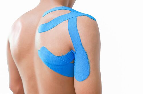 taping muskelkater schulter