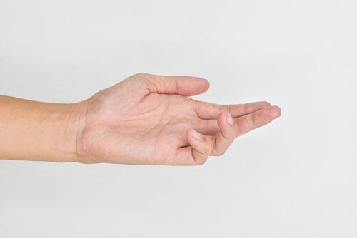 dupuytren