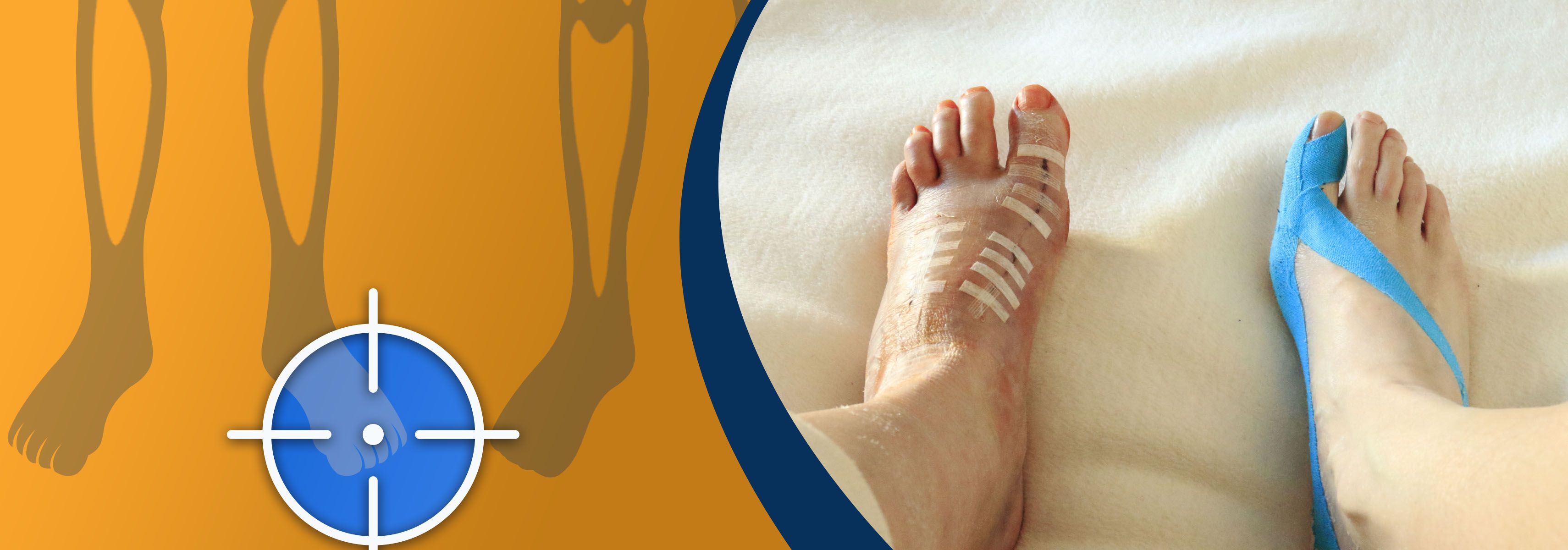 How do you properly tape your toe