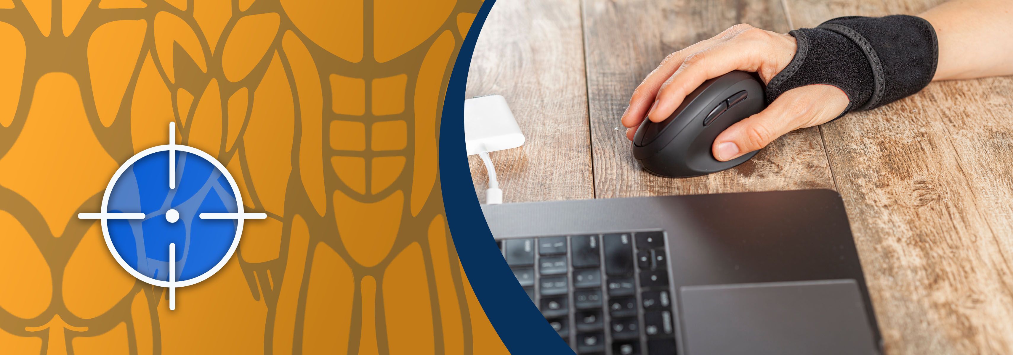 top 3 braces for broken metacarpals