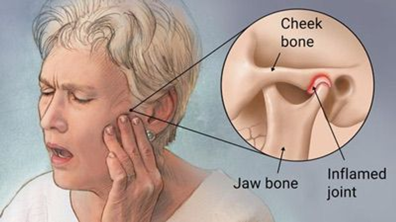 TMJ (Jaw Joint) Treatment
