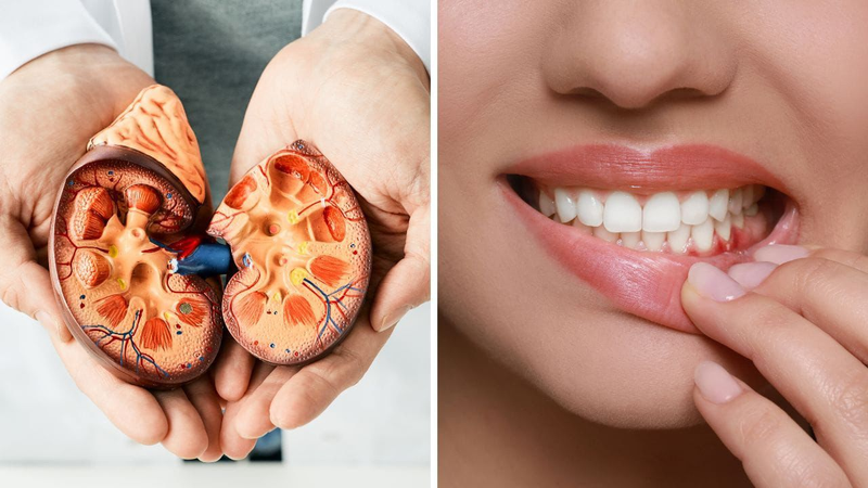 Dental Treatment for Kidney Patients