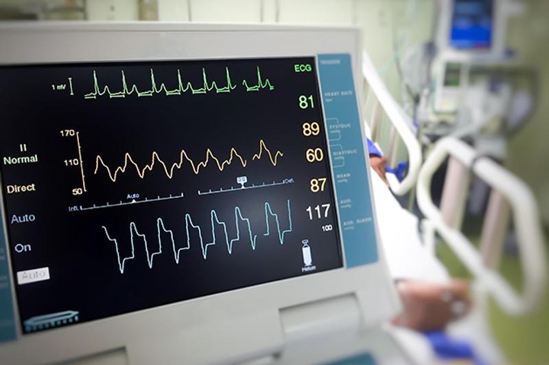 Emergency Cardiac Monitor & Oxygen Facility