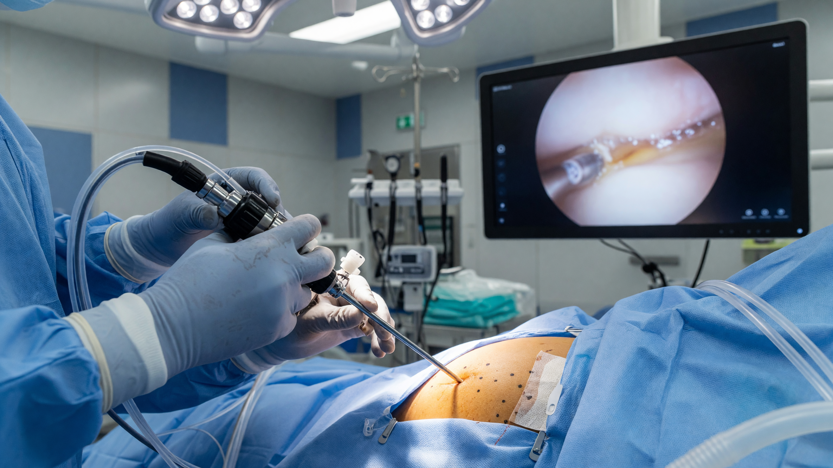 Orthopaedic surgeon performing shoulder arthroscopy to treat persistent shoulder pain