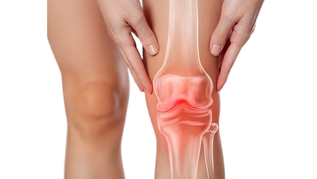ACL tear treatment by Dr Bathini Hithesh sports surgeon using arthroscopic reconstruction
