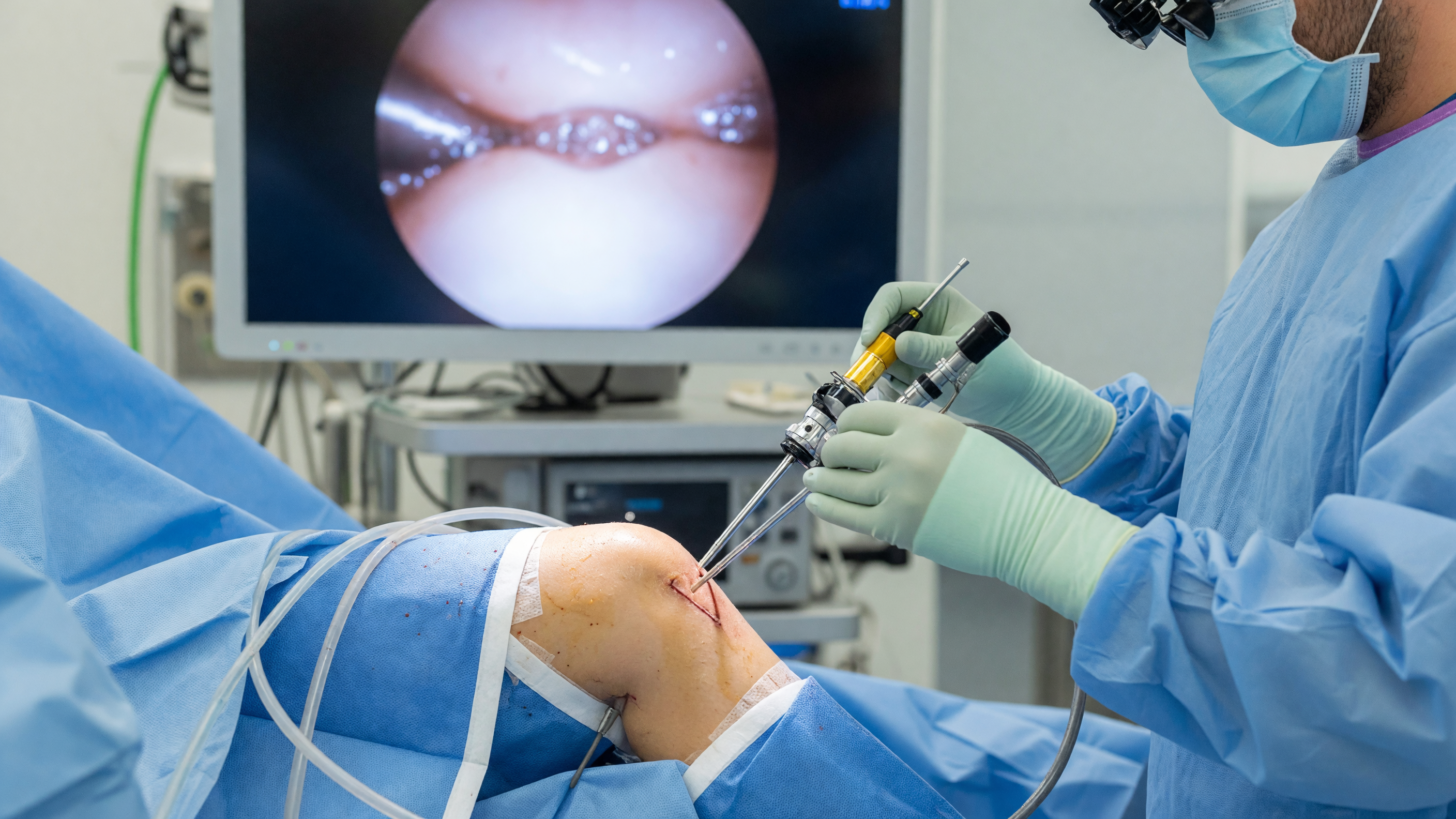 Surgeon performing knee arthroscopy using an arthroscope on a patient's knee joint