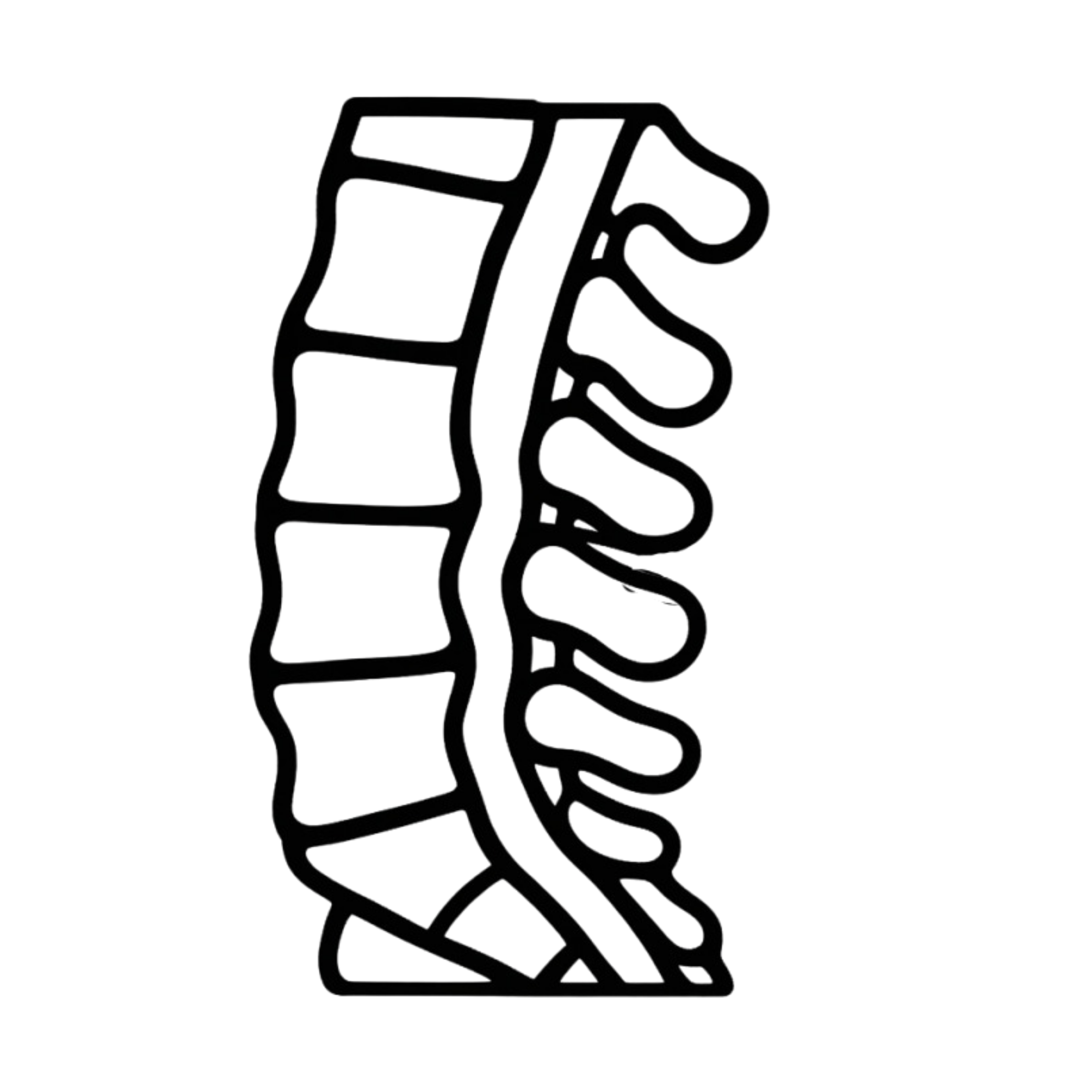 Lumbar Canal Stenosis