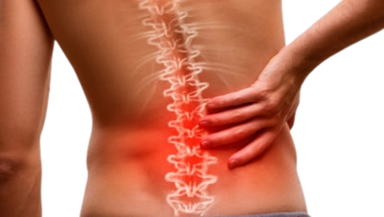 Lumbar canal stenosis treatment by Dr Bathini Hithesh spine surgeon using decompression surgery