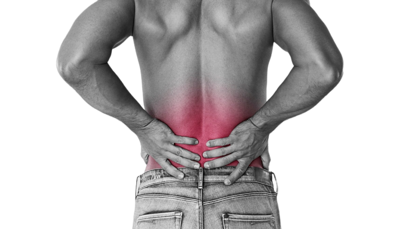Spondylolisthesis treatment by Dr Bathini Hithesh spine surgeon using TLIF fusion surgery