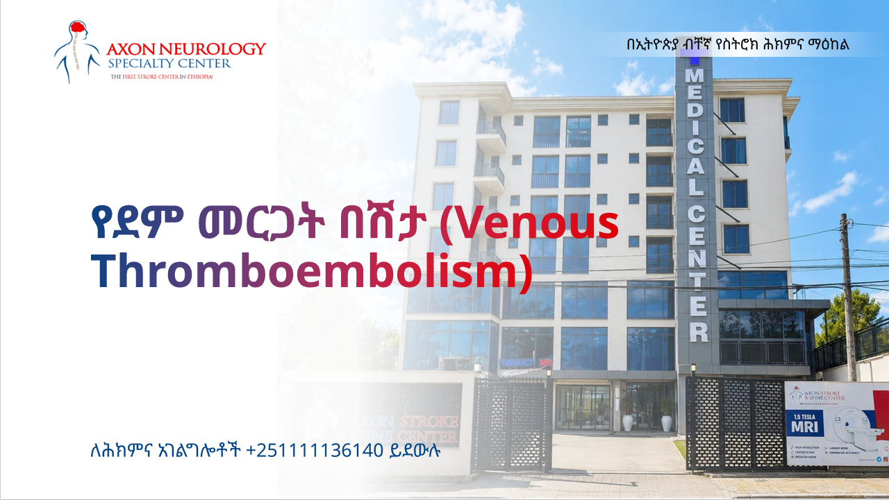  የደም መርጋት በሽታ (Venous Thromboembolism)