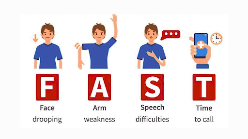 Symptoms of Stroke