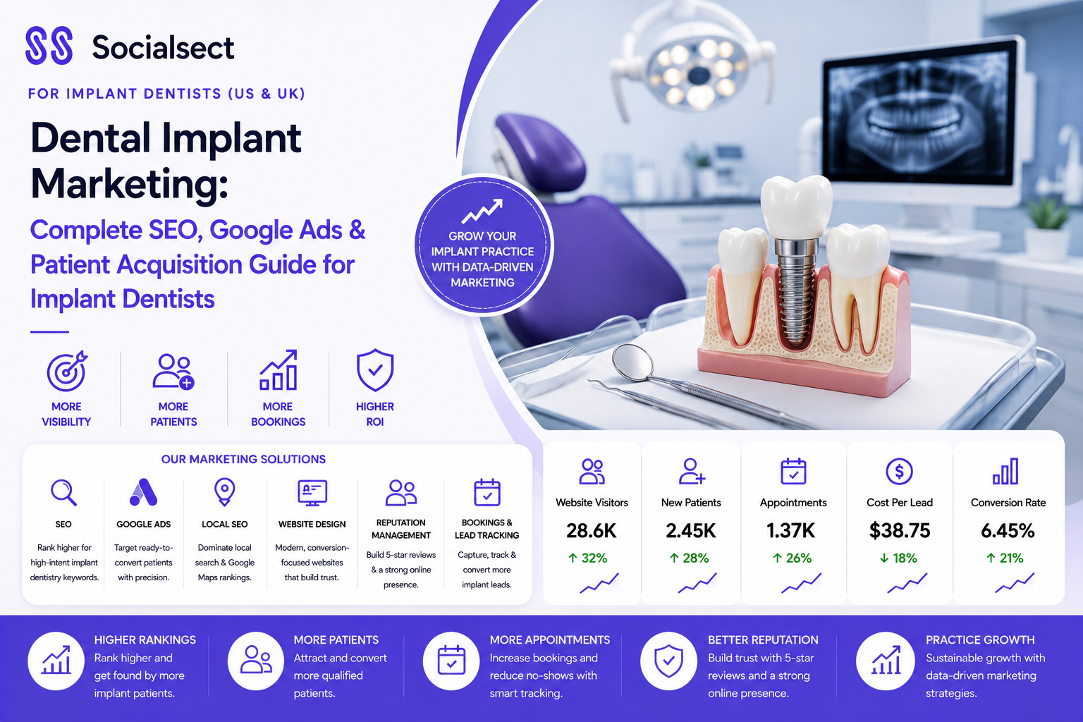 Dental Implant Marketing